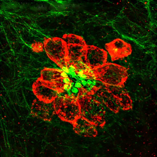 Immunofluorescent image of zebrafish lateral line hair cells at 5dpf labeled with DSHB antibody HCS-1 against Otoferlin; Hair cell soma-1 (red). PMID: 30310154, Fig. 5G.